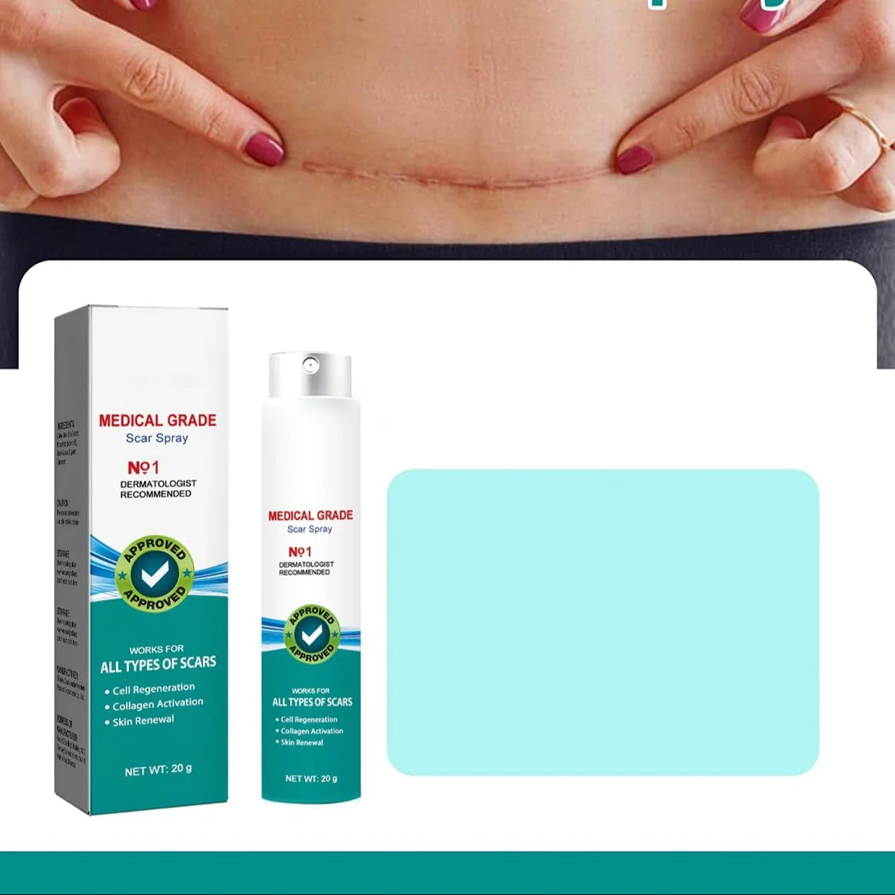 ScarRemoveTM Advanced Scar Spray For All Types of Scars-70%OFF