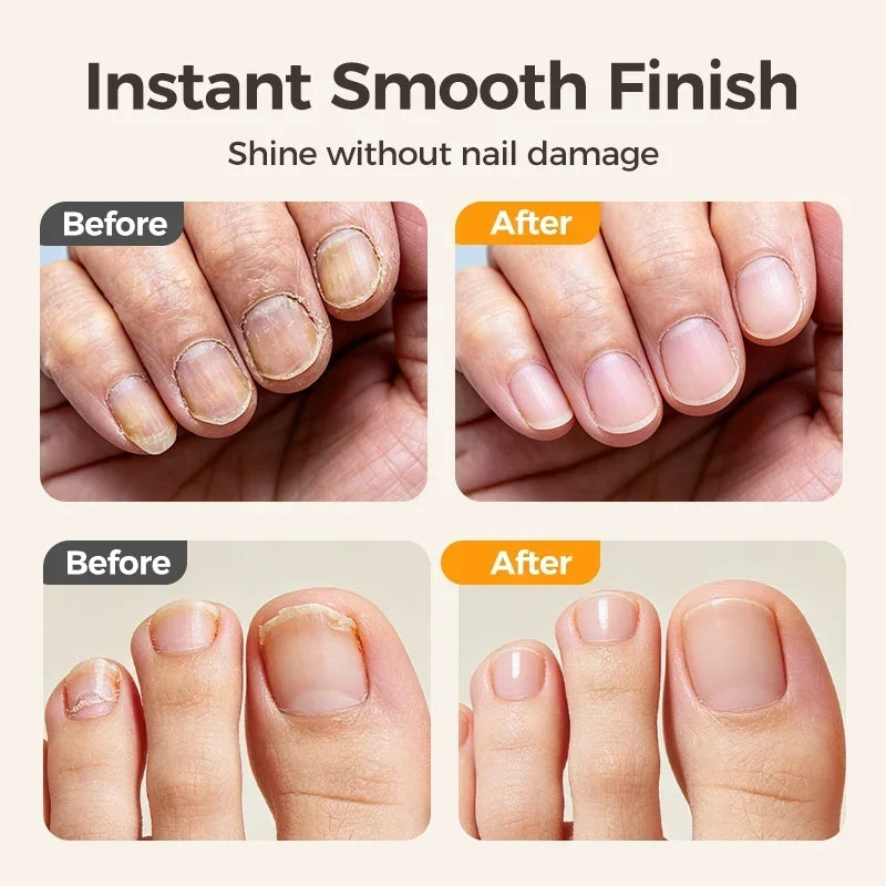 A🔥Last Day 50% OFF -✂️ 2-in-1 Smart Electric Nail Clipper & Polisher – Anti-Pinch Safety & LED Light 💅