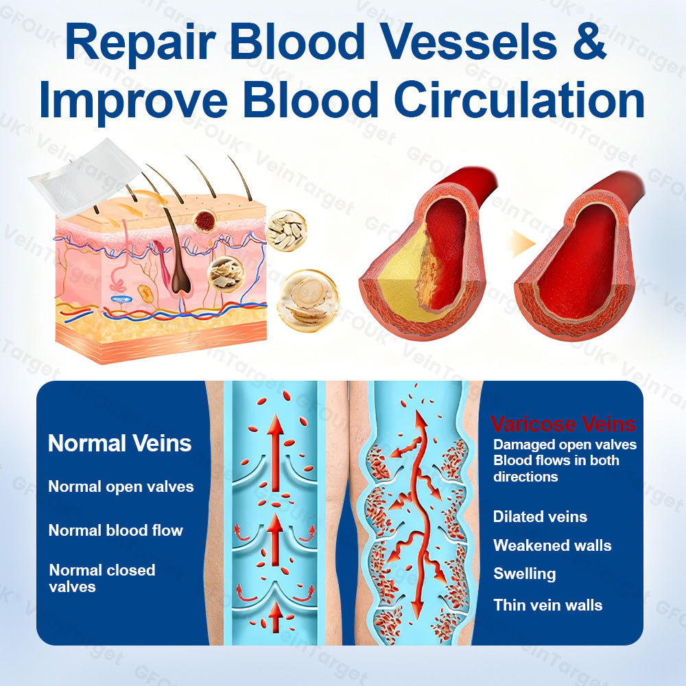 🇺🇸👨‍⚕️👍✅GFOUK® VeinTarget Microneedle Patch⚡Instant Relief, Long-Term Results